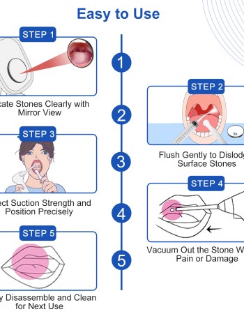 Tonsil Stone Vacuum Remover with LED Light Upgraded Electronic Oral Care Cleaning Tool Set 6 Suction Levels for Fresh Breath & Comfortable Use (White)